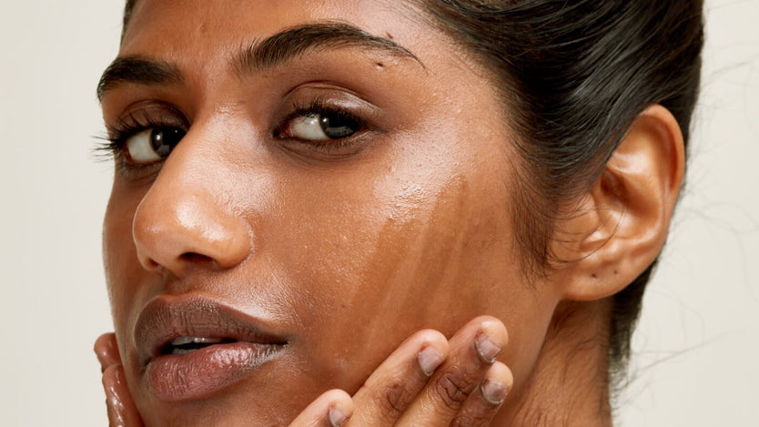 How to manage oily skin and acne
