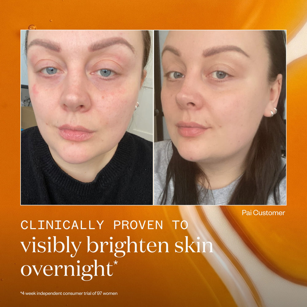 Rosehip Bioregenerate™ Face Oil