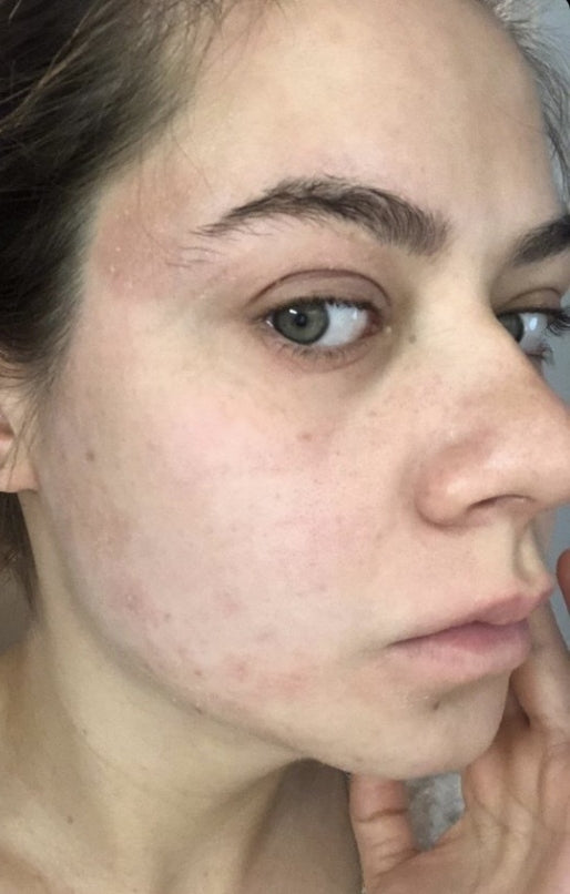 High-tech formulas for real results