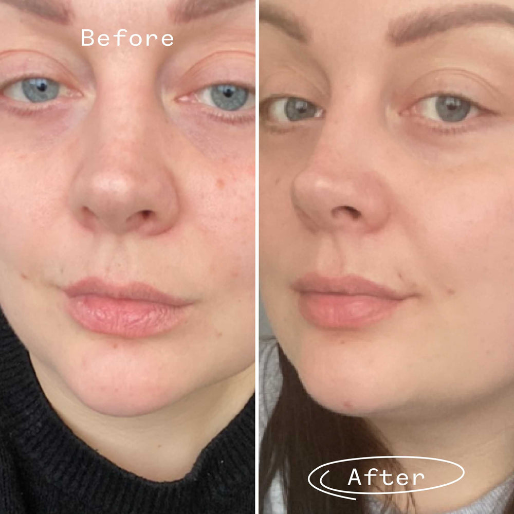 rose hip seed oil face Rosehip Bioregenerate™ Face Oil